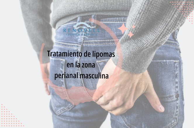 Tratamiento-de-lipomas